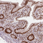 NUP50 Antibody in Immunohistochemistry (Paraffin) (IHC (P))