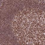 NUP50 Antibody in Immunohistochemistry (Paraffin) (IHC (P))