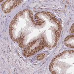 NUP50 Antibody in Immunohistochemistry (Paraffin) (IHC (P))