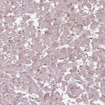NUP50 Antibody in Immunohistochemistry (Paraffin) (IHC (P))
