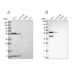 NUP50 Antibody in Western Blot (WB)