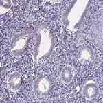 GPX4 Polyclonal Antibody