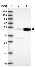 CSTF1 Antibody in Western Blot (WB)