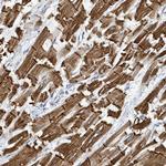 SIRPB1 Polyclonal Antibody