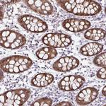 Thioredoxin 1 Antibody in Immunohistochemistry (Paraffin) (IHC (P))
