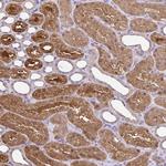 Thioredoxin 1 Antibody in Immunohistochemistry (Paraffin) (IHC (P))