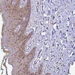 Thioredoxin 1 Antibody in Immunohistochemistry (Paraffin) (IHC (P))