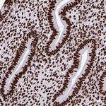 SFPQ Antibody in Immunohistochemistry (Paraffin) (IHC (P))