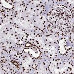 SFPQ Antibody in Immunohistochemistry (Paraffin) (IHC (P))