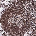 SFPQ Antibody in Immunohistochemistry (Paraffin) (IHC (P))