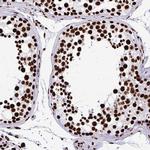 SFPQ Antibody in Immunohistochemistry (Paraffin) (IHC (P))