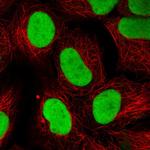 Ku70 Polyclonal Antibody