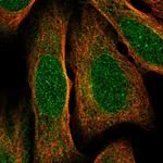 KV3.1 (KCNC1) Polyclonal Antibody