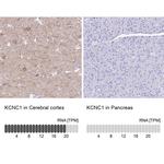 KV3.1 (KCNC1) Antibody