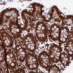 FUBP3 Polyclonal Antibody