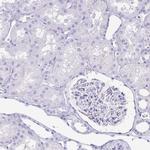 GKN1 Antibody in Immunohistochemistry (Paraffin) (IHC (P))