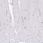 GKN1 Antibody in Immunohistochemistry (Paraffin) (IHC (P))