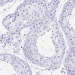 GKN1 Antibody in Immunohistochemistry (Paraffin) (IHC (P))