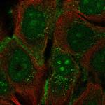 PCDH1 Polyclonal Antibody