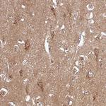 PCDH1 Antibody in Immunohistochemistry (Paraffin) (IHC (P))