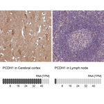 PCDH1 Antibody in Immunohistochemistry (Paraffin) (IHC (P))
