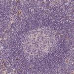 PCDH1 Antibody in Immunohistochemistry (Paraffin) (IHC (P))