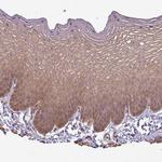 PCDH1 Antibody in Immunohistochemistry (Paraffin) (IHC (P))
