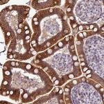 PCDH1 Antibody in Immunohistochemistry (Paraffin) (IHC (P))