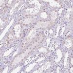 HSD11B1 Antibody in Immunohistochemistry (Paraffin) (IHC (P))