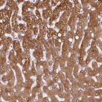 HSD11B1 Antibody in Immunohistochemistry (Paraffin) (IHC (P))