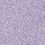 HSD11B1 Polyclonal Antibody