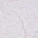 HSD11B1 Antibody in Immunohistochemistry (Paraffin) (IHC (P))