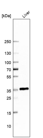 HSD11B1 Antibody in Western Blot (WB)