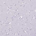Cathepsin G Antibody in Immunohistochemistry (Paraffin) (IHC (P))