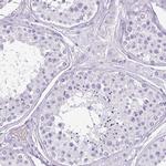 Cathepsin G Antibody in Immunohistochemistry (Paraffin) (IHC (P))