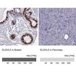 ELOVL5 Antibody