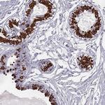ELOVL5 Antibody in Immunohistochemistry (Paraffin) (IHC (P))