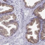 ELOVL5 Antibody in Immunohistochemistry (Paraffin) (IHC (P))
