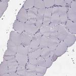 ELOVL5 Antibody in Immunohistochemistry (Paraffin) (IHC (P))