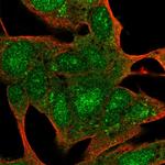 C22orf41 Polyclonal Antibody