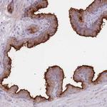 PPAP2A Antibody in Immunohistochemistry (Paraffin) (IHC (P))