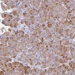 PLA2 Antibody in Immunohistochemistry (Paraffin) (IHC (P))