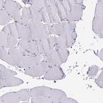 PLA2 Polyclonal Antibody