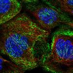 Septin-10 Polyclonal Antibody