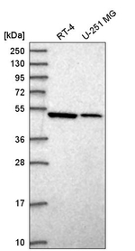 Septin-10 Antibody in Western Blot (WB)