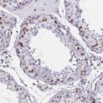 Lamin B2 Antibody in Immunohistochemistry (Paraffin) (IHC (P))
