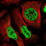 SEPHS2 Polyclonal Antibody