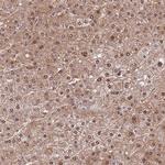 SEPHS2 Antibody in Immunohistochemistry (Paraffin) (IHC (P))