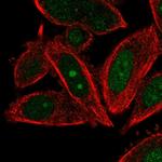 POLE3 Polyclonal Antibody