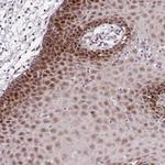 POLE3 Antibody in Immunohistochemistry (Paraffin) (IHC (P))